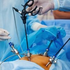 Laparoscopic Surgery for an Ectopic Pregnancy